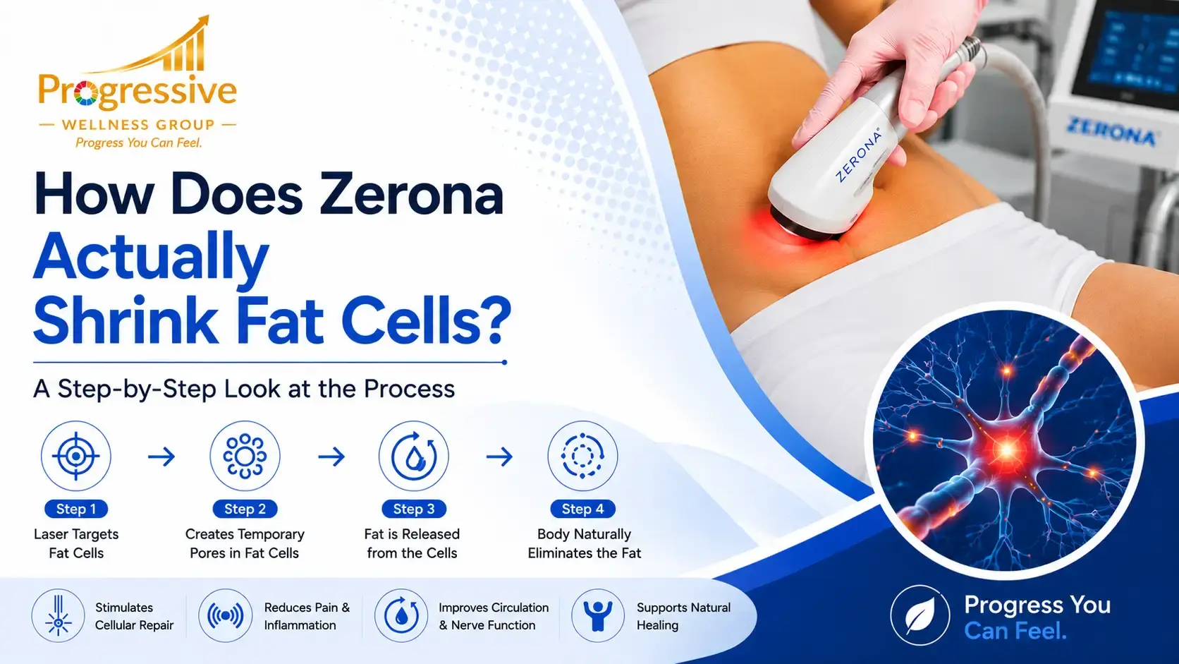 How Does Zerona Actually Shrink Fat Cells? A Step-by-Step Look at the Process